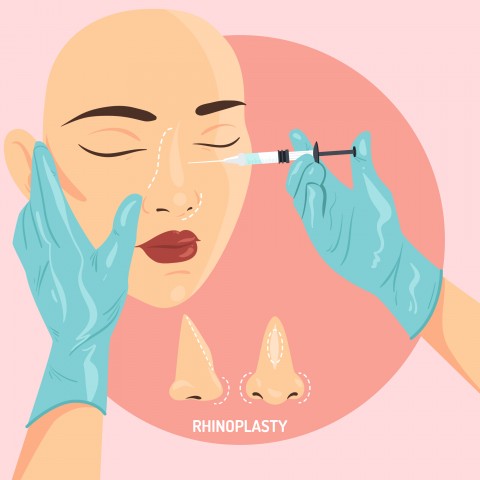 Rhinoplastie sans chirurgie ? Aujourd'hui, c'est possible !